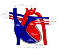  Hình ảnh Hẹp eo động mạch chủ tại eo, ngay dưới động mạch dưới đòn trái