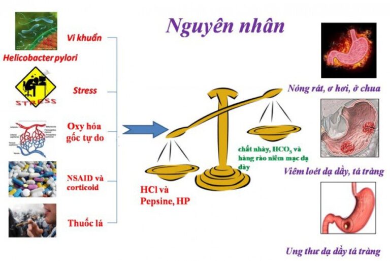 Trào ngược dạ dày, thực quản