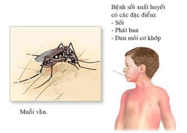 Triệu chứng dengue xuất huyết thể điển hình (độ II)