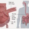 Bệnh Crohn – nguyên nhân, triệu chứng, điều trị