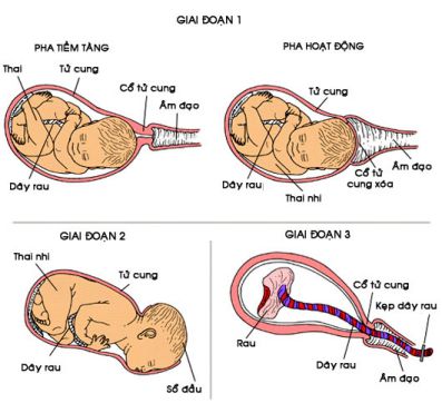 cac-giai-doan-chuyen-da