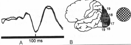 Trung khu vỏ não thị giác và hình dạng VEP