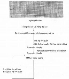 Ngừng tim trẻ em