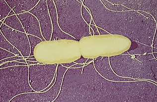 Trực khuẩn thương hàn (Salmonella typhi)