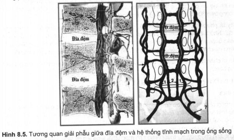 Phương pháp chụp tĩnh mạch ống sống thắt lưng