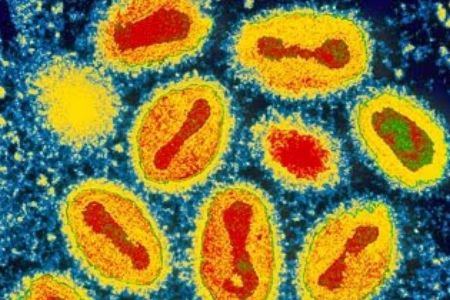 Triệu chứng và điều trị virus đậu mùa